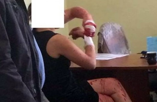 Росіянка накинулася з ножем на співробітницю РАГСу у Львові