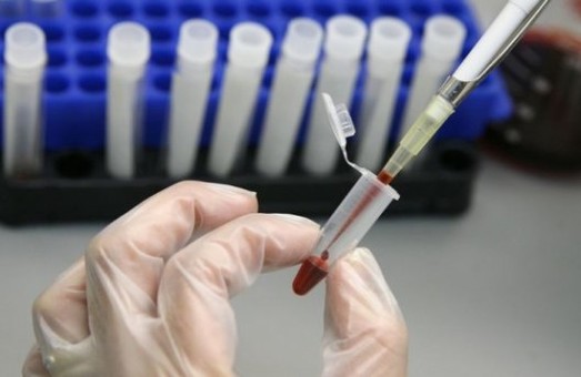 На Харківщині 41 людина захворіла на гепатит А