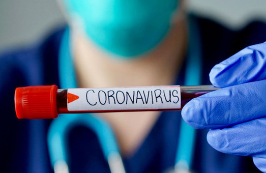 Харківська обласна інфекційна лікарня замовила сотні сумнівних тестів на COVID-19 - ХАЦ