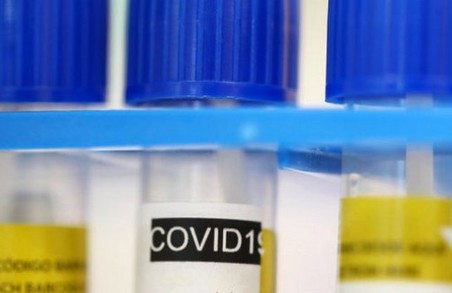 За останню добу в області підтверджено 17 нових випадків захворювання на COVID-19