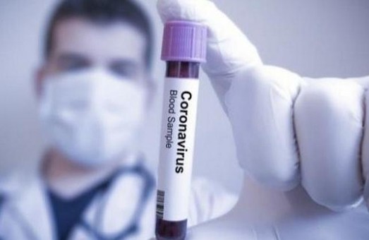 У Харкові на коронавірус хворіют 100 людей