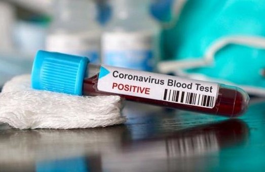 У Харкові - 182 нових випадки захворювання на коронавірус