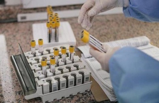 Харків’яни можуть зробити тестування на COVID-19 у 8 лабораторіях