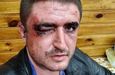 На Харківщині поліцейські побили лікаря: інсайдерські подробиці